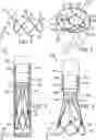 Fig. 02 - Valvular insufficiency repair device and method