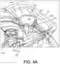 Fig. 07 - INFLATABLE PENILE PROSTHESIS WITH GUIDES IN VALVE OF PUMP ASSEMBLY