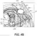 Fig. 08 - INFLATABLE PENILE PROSTHESIS WITH GUIDES IN VALVE OF PUMP ASSEMBLY