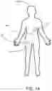 Fig. 02 - SYSTEMS AND METHODS FOR CLASSIFYING MOTION OF A PATIENT WEARING AN AMBULATORY MEDICAL DEVICE