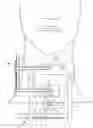 Fig. 01 - Retractor, distractor, and camera system for cervical procedures
