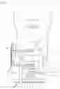 Fig. 02 - Retractor, distractor, and camera system for cervical procedures