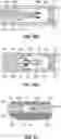 Fig. 35 - Catheter with shock wave electrodes aligned on longitudinal axis