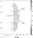 Fig. 76 - Catheter with shock wave electrodes aligned on longitudinal axis