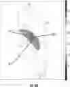 Fig. 77 - Catheter with shock wave electrodes aligned on longitudinal axis