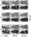 Fig. 49 - Methods for treating hair loss disorders