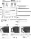 Fig. 03 - METHODS, SYSTEMS, PROGRAMS AND DEVICES TO PREDICT PATIENT OUTCOME USING DIFFERENTIAL IN PUPILLARY INDEX