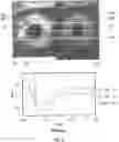Fig. 06 - METHODS, SYSTEMS, PROGRAMS AND DEVICES TO PREDICT PATIENT OUTCOME USING DIFFERENTIAL IN PUPILLARY INDEX