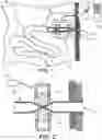 Fig. 02 - METHOD FOR A SEALING DEVICE FOR AN INTESTINAL STOMA