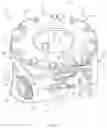 Fig. 05 - Expandable Vertebral Implant and Method
