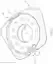 Fig. 24 - Expandable Vertebral Implant and Method