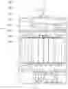Fig. 02 - LADCP and USBL combined observation device and application method thereof