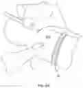 Fig. 07 - DEVICE AND METHOD FOR ASSISTING BREATHING IN A SUBJECT