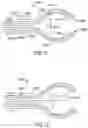 Fig. 08 - SIDE LOOKING MINIMALLY INVASIVE SURGERY INSTRUMENT ASSEMBLY