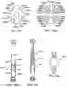 Fig. 15 - SIDE LOOKING MINIMALLY INVASIVE SURGERY INSTRUMENT ASSEMBLY