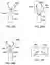 Fig. 36 - SIDE LOOKING MINIMALLY INVASIVE SURGERY INSTRUMENT ASSEMBLY