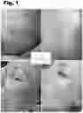 Fig. 02 - Oral Supplement to Trigger Repair Of Organs