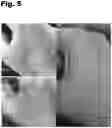 Fig. 06 - Oral Supplement to Trigger Repair Of Organs