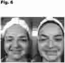 Fig. 07 - Oral Supplement to Trigger Repair Of Organs