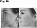 Fig. 11 - Oral Supplement to Trigger Repair Of Organs