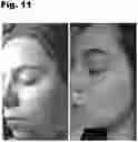 Fig. 12 - Oral Supplement to Trigger Repair Of Organs
