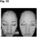 Fig. 13 - Oral Supplement to Trigger Repair Of Organs