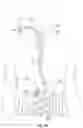 Fig. 04 - AUTOMATIC POSITIONING AND FORCE ADJUSTMENT IN ENDOSCOPY