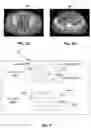 Fig. 02 - Systems and methods for pseudo image data augmentation for training machine learning models