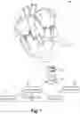 Fig. 02 - MACHINE LEARNING SYSTEM FOR, AND METHOD OF ASSESSING AND GUIDING MYOCARDIAL TISSUE ABLATION AND ELIMINATION OF ARRHYTHMIA