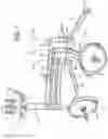 Fig. 02 - Load balancing arm for medical device support system