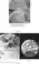 Fig. 09 - YEAST AND LACTIC ACID BACTERIA COMBINATION