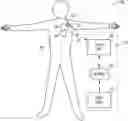 Fig. 01 - SYSTEMS AND METHODS FOR HEART FAILURE MANAGEMENT