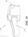 Fig. 45 - SURGICAL VISUALIZATION SYSTEMS AND DISPLAYS