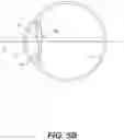Fig. 07 - Systems and methods for vergence matching of an intraocular lens with refractive index writing