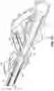 Fig. 21 - CANNULA INSERTION SYSTEM AND METHODS OF USING THE SAME