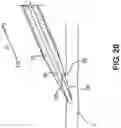 Fig. 27 - CANNULA INSERTION SYSTEM AND METHODS OF USING THE SAME