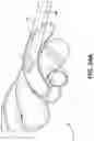 Fig. 31 - CANNULA INSERTION SYSTEM AND METHODS OF USING THE SAME