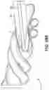 Fig. 32 - CANNULA INSERTION SYSTEM AND METHODS OF USING THE SAME