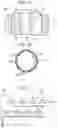 Fig. 02 - ELECTRODE DEVICES FOR NEUROSTIMULATION