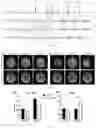 Fig. 02 - 3D oscillating gradient-prepared gradient spin-echo imaging method, and device