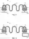 Fig. 09 - Vehicle body attachment assembly