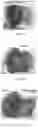 Fig. 03 - MONOVALENT VACCINE FORMULATION AND A METHOD FOR PREPARATION THEREOF
