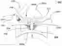 Fig. 01 - SYSTEMS AND METHODS FOR CROSS-LINKING TREATMENTS OF AN EYE