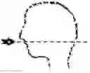 Fig. 02 - PERSONALIZED MEDICAL DEVICE AND METHOD OF ITS PREPARATION