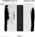 Fig. 15 - IMMUNOTHERAPEUTIC MODULATION OF AMYLOIDOGENIC DISEASE USING NON-FIBRILLOGENIC, NON-AMYLOIDOGENIC POLYMERIZED PROTEINS AND PEPTIDES