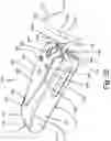 Fig. 28 - Resilient body component contact for a subcutaneous device