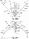 Fig. 32 - Resilient body component contact for a subcutaneous device
