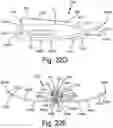 Fig. 33 - Resilient body component contact for a subcutaneous device