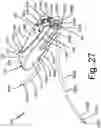 Fig. 43 - Resilient body component contact for a subcutaneous device