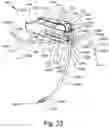 Fig. 55 - Resilient body component contact for a subcutaneous device